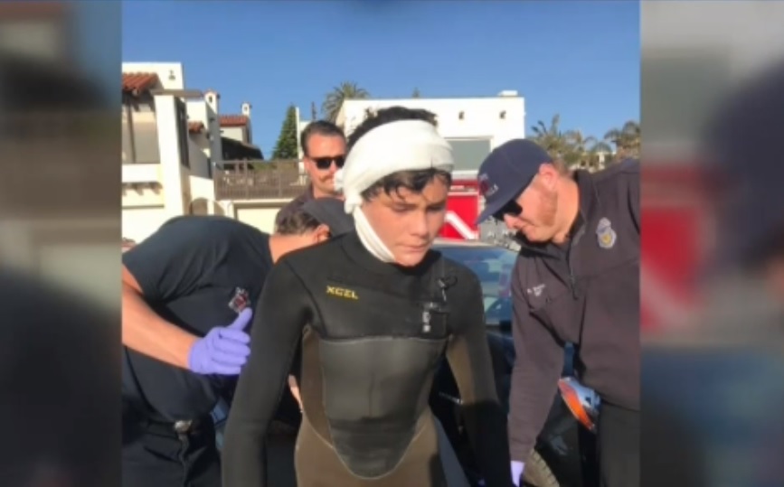Joven surfista profesional es apu&ntilde;alado en la cabeza por su propia tabla 